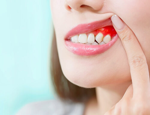 Study links periodontal disease to autoimmune disease and all-cause mortality